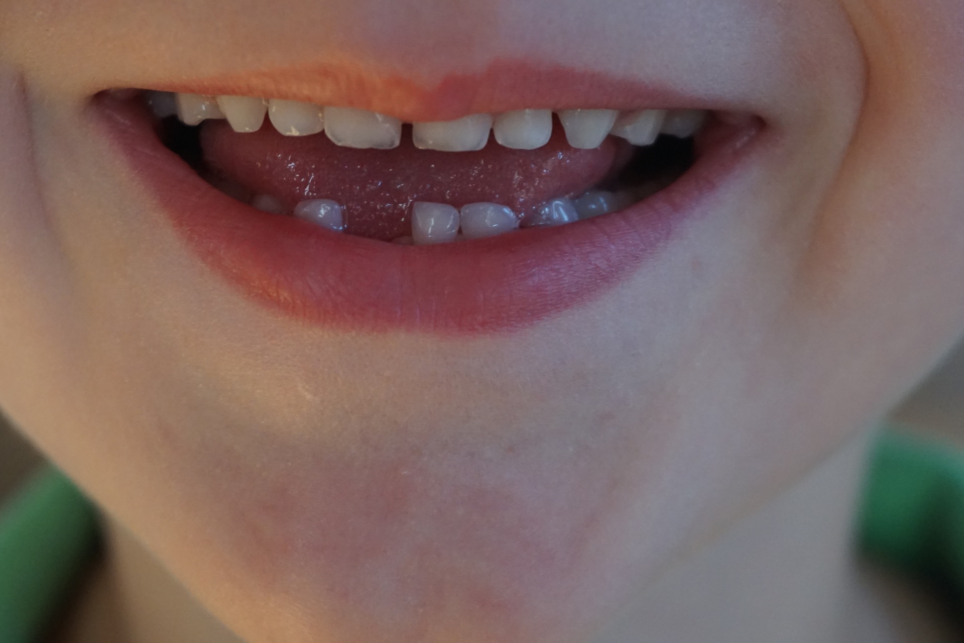 Tooth Fairy