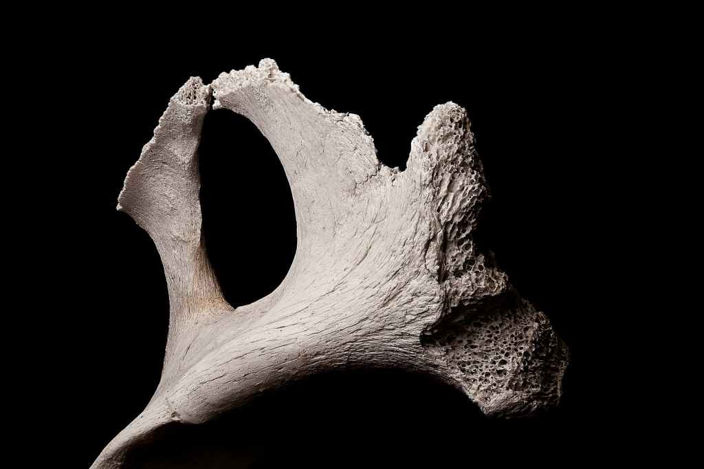 Inventario Post Mortem